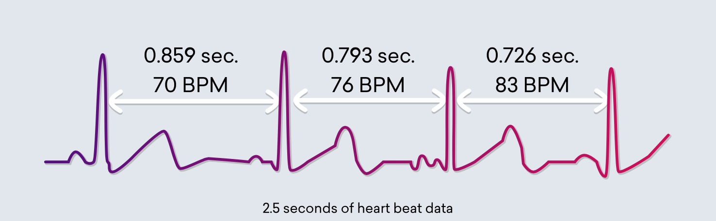 Biofeedback